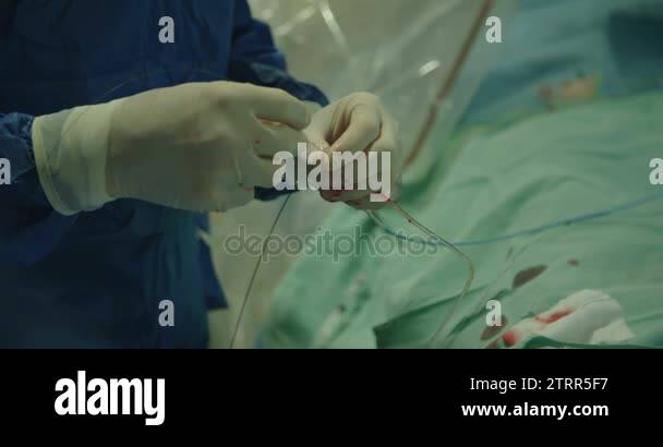 Cardiac Cath Lab Animation Cardiac cath lab Stock Videos & Footage - HD and 4K Video Clips - Alamy