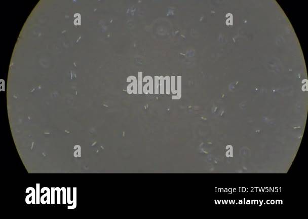Microscope Live Image Live bacteria under microscope Stock Video Footage - Alamy