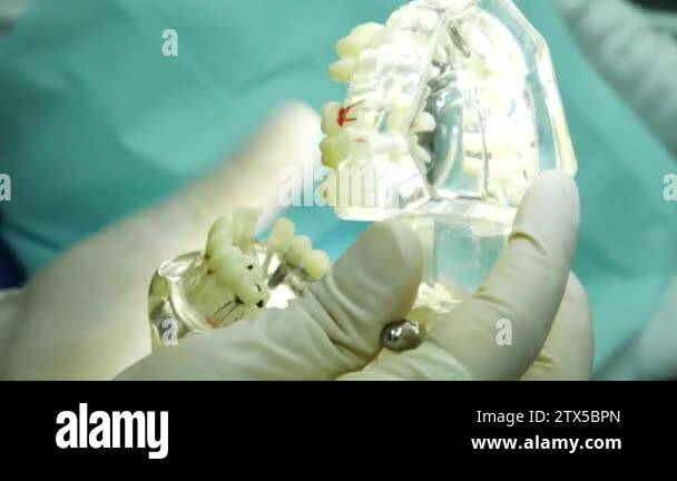 dentist doctor shows a model layout of teeth technical healthcare Stock ...