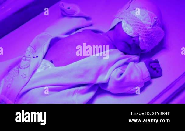 newborn under ultraviolet lamp. treatment of elevated bilirubin in ...