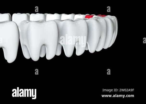 White teeth row stomatology Stock Videos & Footage - HD and 4K Video ...