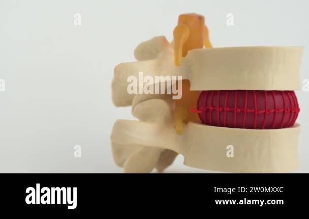 Intervertebral vertebrae Stock Videos & Footage - HD and 4K Video Clips ...