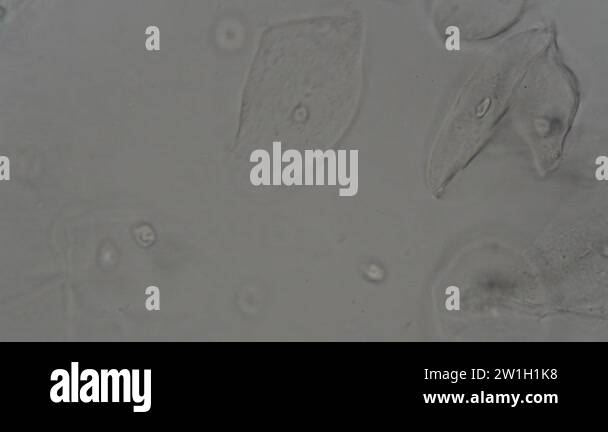 Human epithelial cells microscopy Stock Videos & Footage - HD and 4K ...