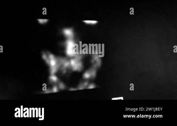 Indium Scanner Ct scan and spect scan Stock Videos & Footage - HD and 4K Video Clips ...