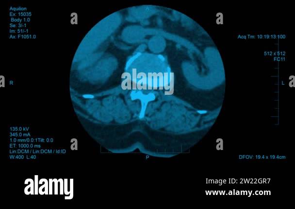Spinal visualization Stock Videos & Footage - HD and 4K Video Clips - Alamy