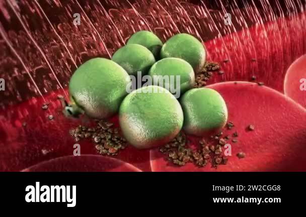 Tetanus bacteria Stock Videos & Footage - HD and 4K Video Clips - Alamy