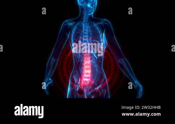 Xray of the lumbar spine Stock Videos & Footage - HD and 4K Video Clips ...