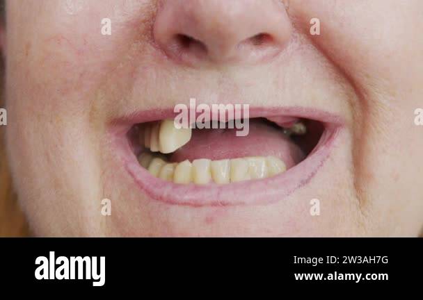 Toothless mouth Stock Videos & Footage - HD and 4K Video Clips - Alamy