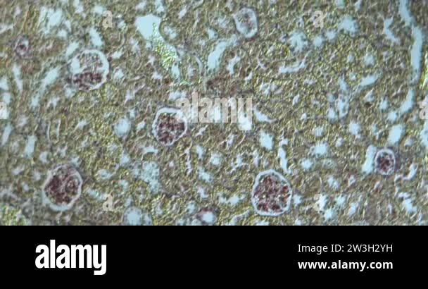 Corpuscles Stock Videos & Footage - HD and 4K Video Clips - Alamy