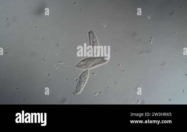 Pond water organisms microscope Stock Videos & Footage - HD and 4K ...