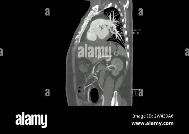 Sagittal plane tomography ct scan Stock Videos & Footage - HD and 4K ...