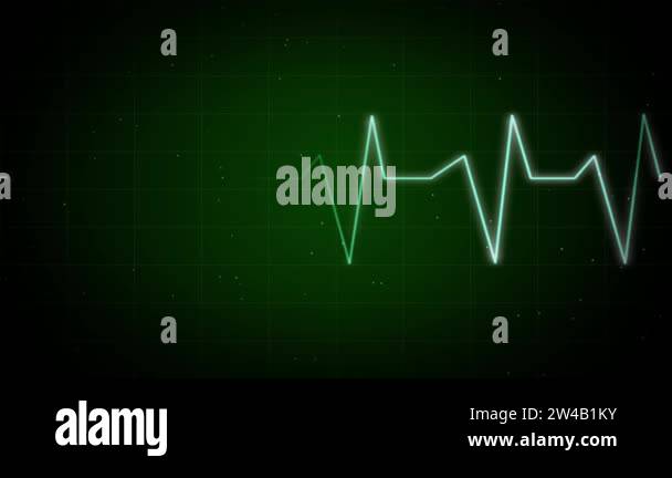 Graph of Heart Rhythm Heartbeat monitor EKG line monitor Loop ...