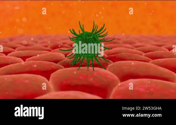 Virus, bacteria, infection inside organism view. Process of infection ...