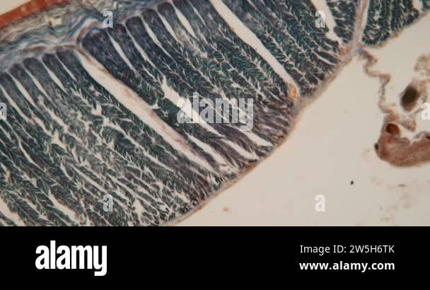 muscles of the earthworm in cross section under the microscope 100x ...