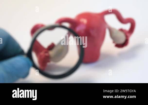 Diagnosis of female sexual reproductive system - ovaries, fallopian ...