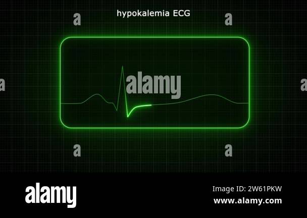 Green light glowing lifeline animation. Electric neon lighting follow ...