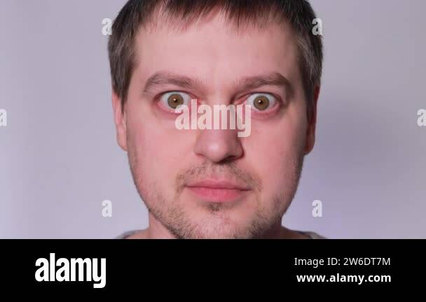 Toxic diffuse goiter Stock Videos & Footage - HD and 4K Video Clips - Alamy