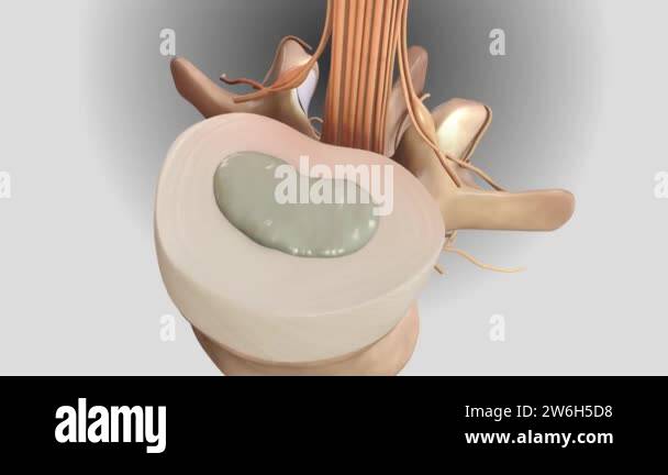Man and back pain and spine Stock Videos & Footage - HD and 4K Video ...