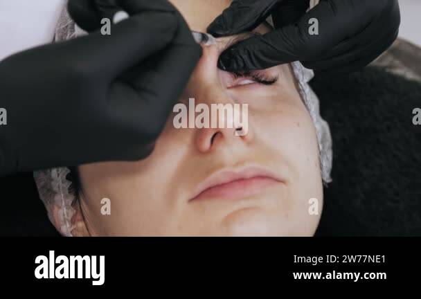 botox injection. beauty injection. anti-aging injections. botulinum ...