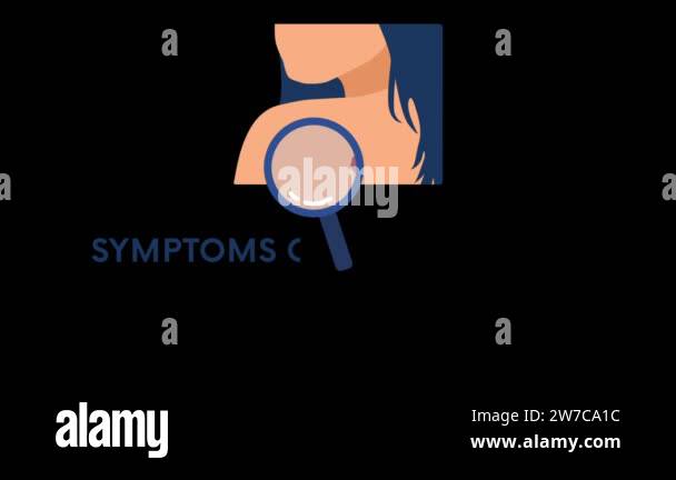 Skin cancer symptoms 2D animation on transparent background. Melanoma ...