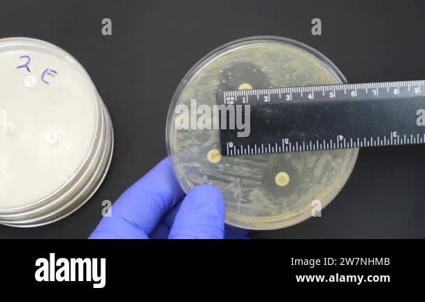 Antibiotic test Stock Videos & Footage - HD and 4K Video Clips - Alamy