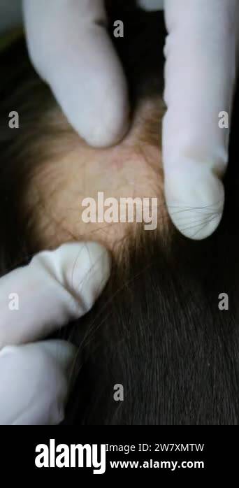 Head inspection Stock Videos & Footage - HD and 4K Video Clips - Alamy