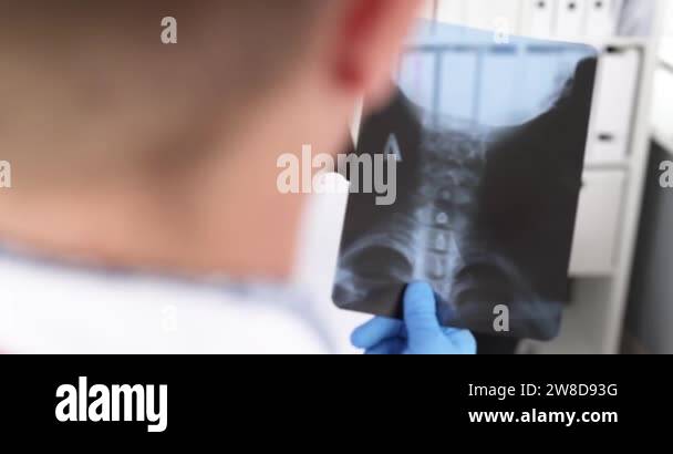 X ray cervical spine Stock Videos & Footage - HD and 4K Video Clips - Alamy