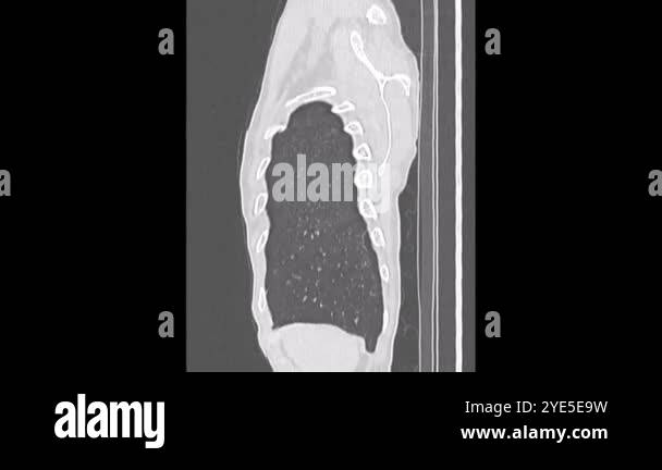 Side view chest ct Stock Videos & Footage - HD and 4K Video Clips - Alamy