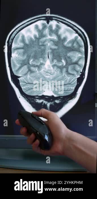 Mouse brain scan Stock Videos & Footage - HD and 4K Video Clips - Alamy