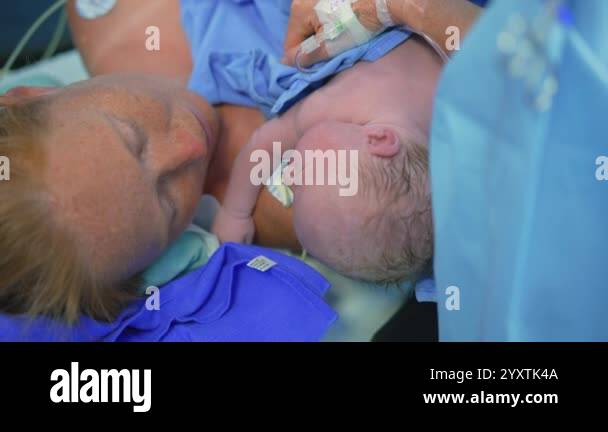 Born Operations A just-born baby is placed on the mothers chest as the surgeon ...
