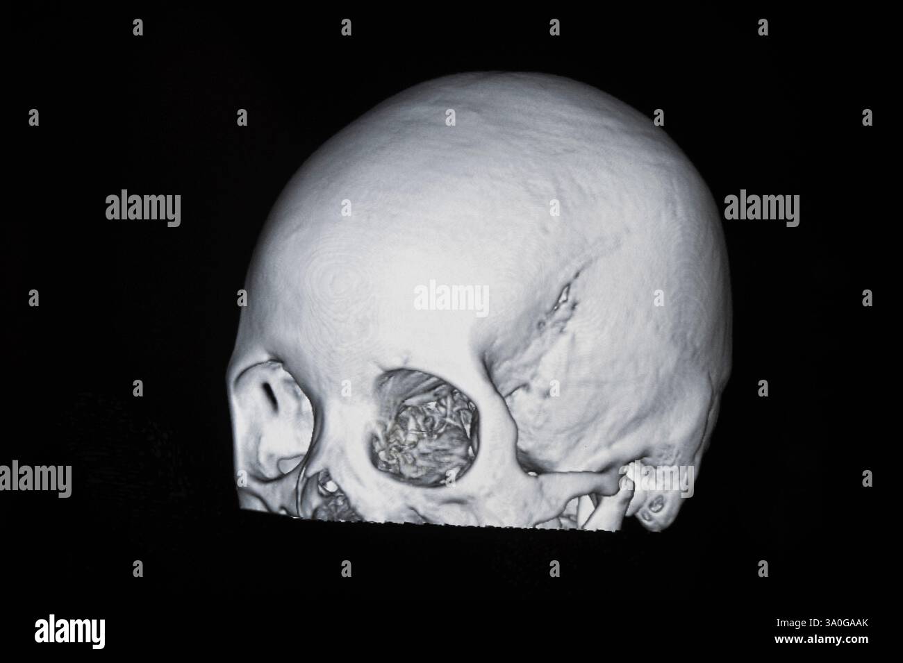 Human skull CT scans Stock Photo - Alamy