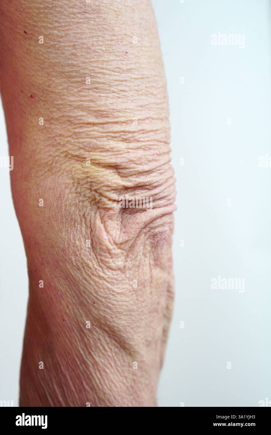 Sagging skin hi-res stock photography and images - Alamy