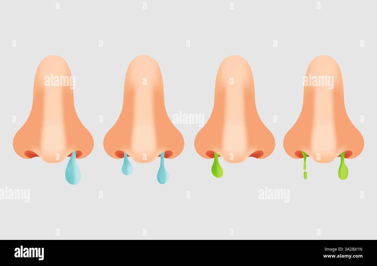 Runny nose sickness allergy symptoms icon. Rhinitis symptoms, treatment ...