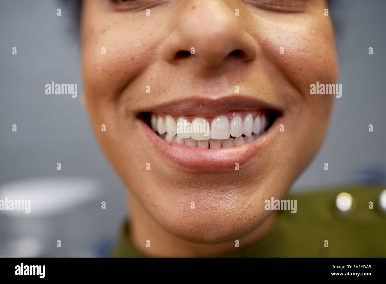 Close-Up of a Woman's Smiling Face Highlighting Clean and White Teeth Stock Photo