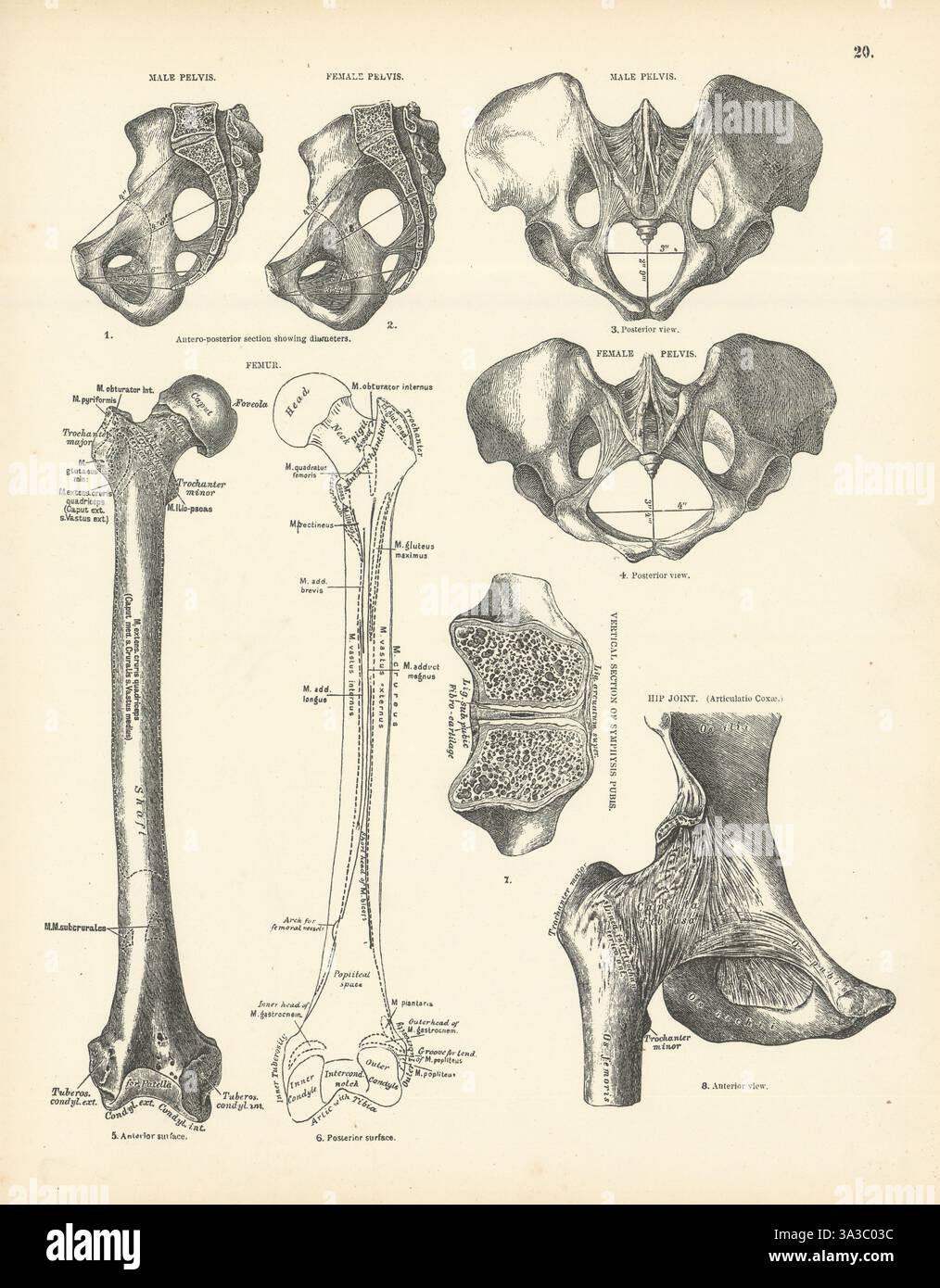 Anatomy. Male & Female Pelvis, Femur, Hip Joint 1880 old antique print picture Stock Photo