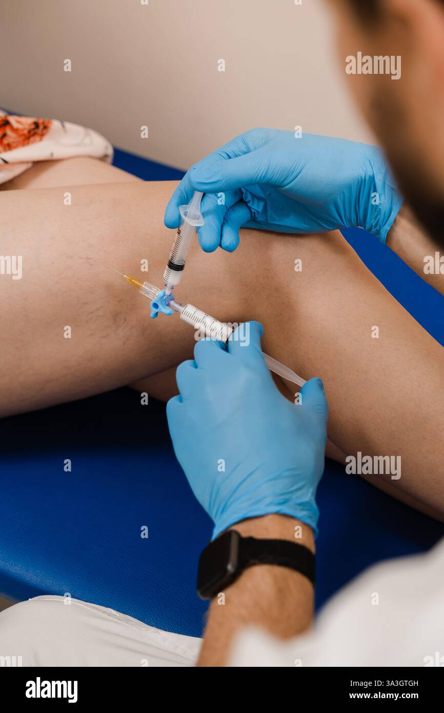 Sclerotherapy injecting into the varicose or spider vein on leg to ...