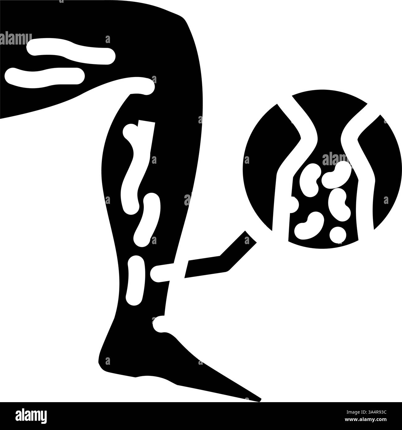 deep vein thrombosis cardiology disease glyph icon vector illustration ...