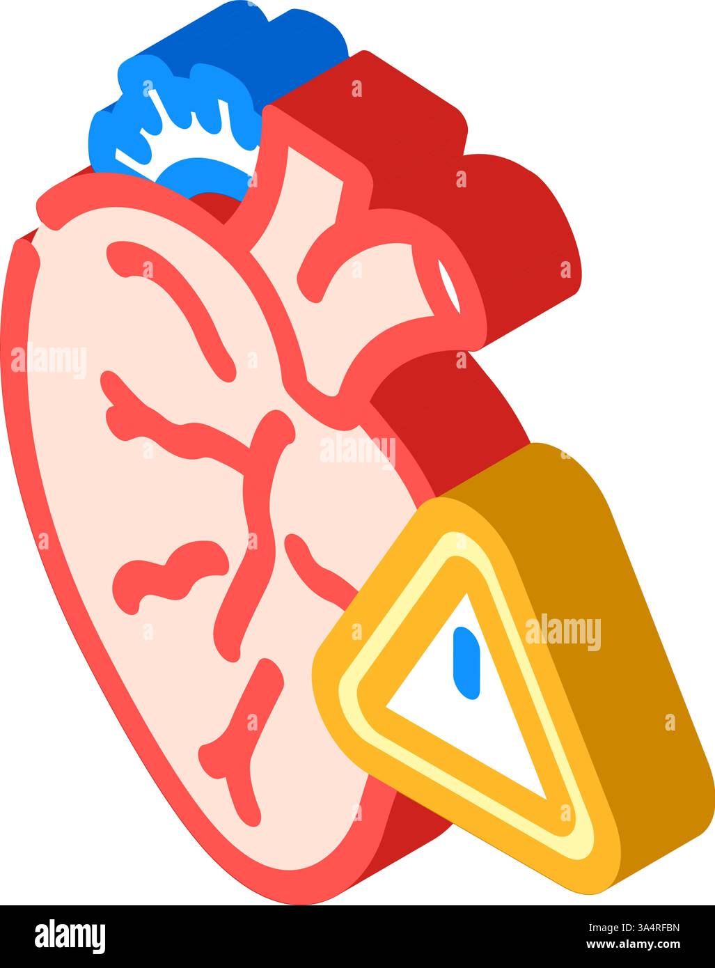 congenital heart disease cardiology isometric icon vector illustration ...