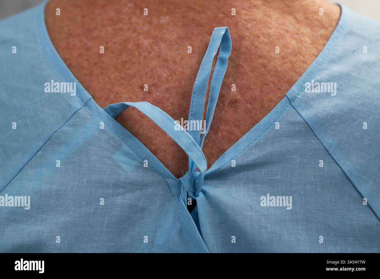 Close-Up Showing Back of Hospital Patient Gown Stock Photo - Alamy