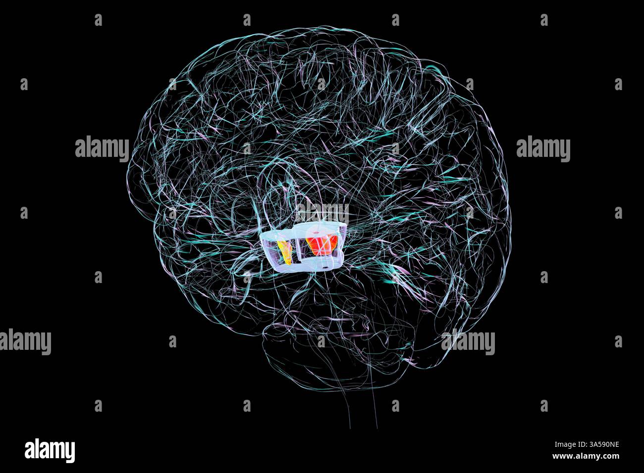 Illustration of the human brain with highlighted substantia nigra ...