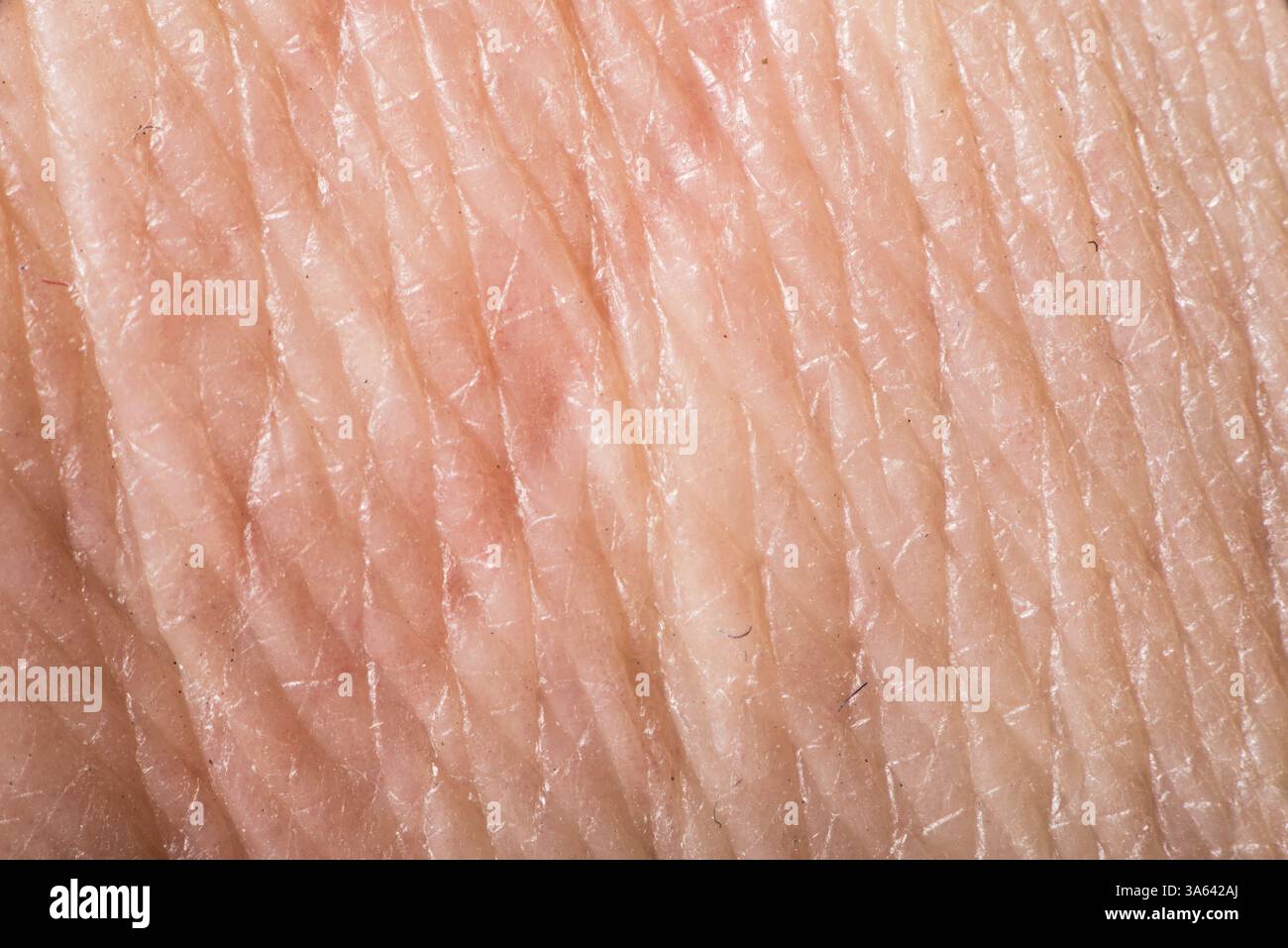 Texture of human skin. Extreme close up macro shot Stock Photo - Alamy