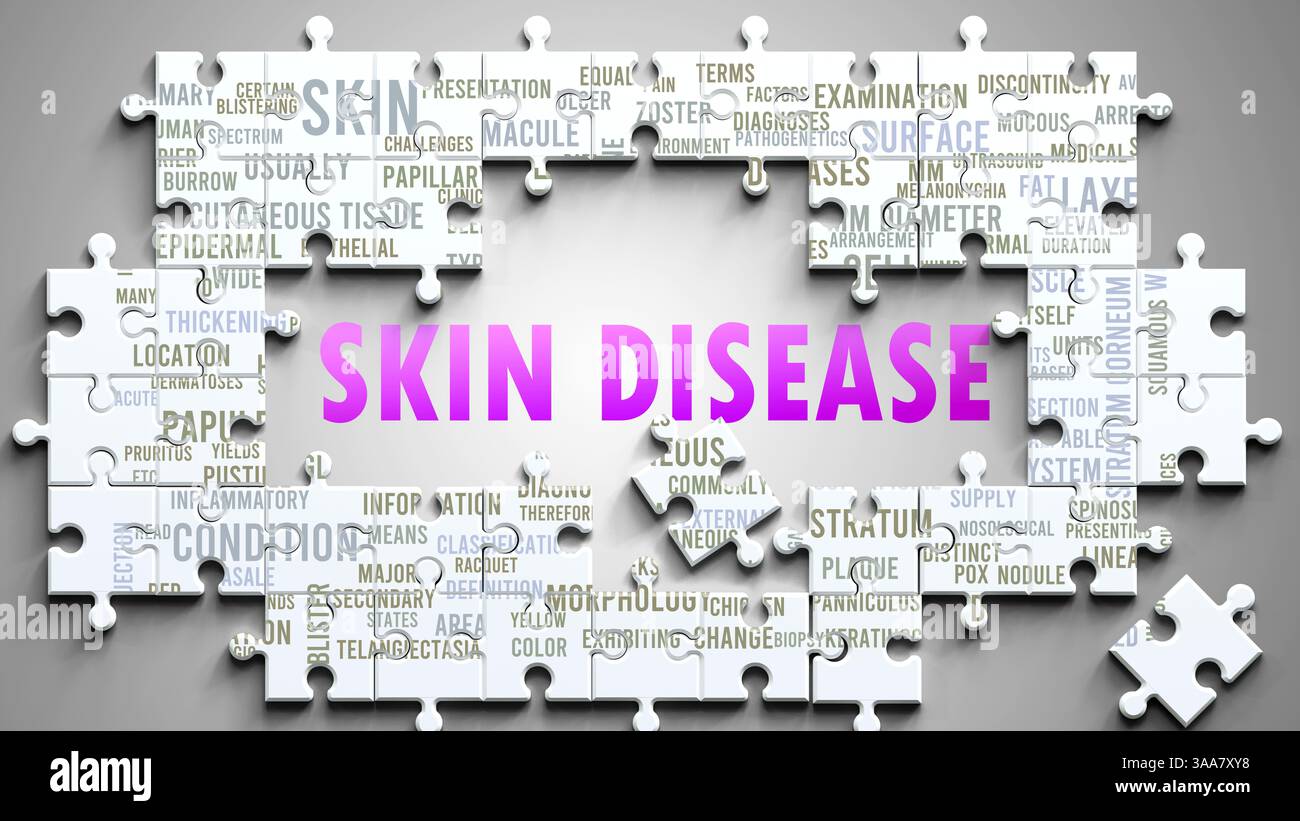 Skin Related Skin Disease being a complex subject, related to other important topics ...