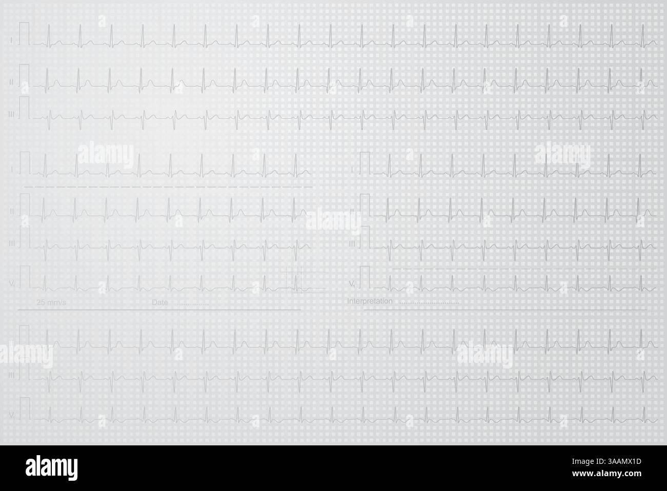 ECG line in the squared notebook, vector image. Stock Vector