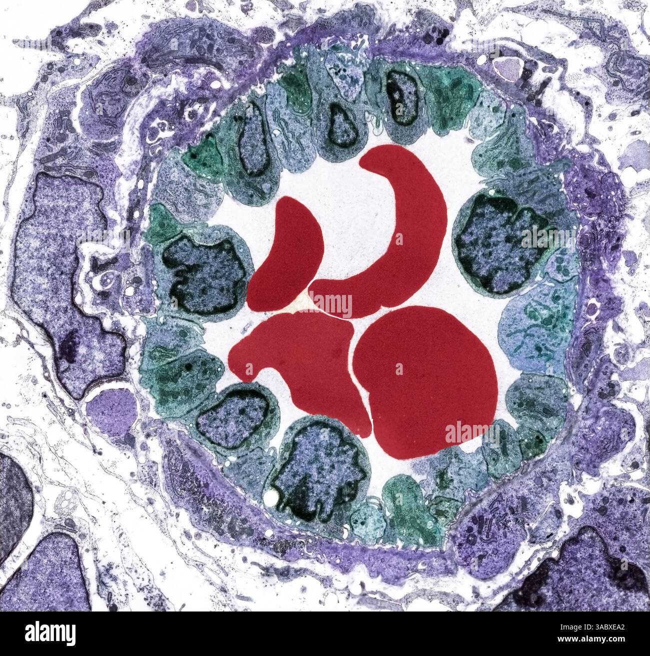 Arteriole. Coloured transmission electron micrograph (TEM) of a section ...