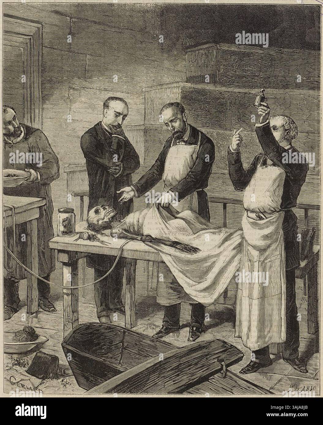 The 1884 illustration by J. Gerlier depicts the autopsy of Eugénie Buffereau, known as Mme Pel, performed in the presence of various medical professionals at the morgue in Paris. Stock Photo