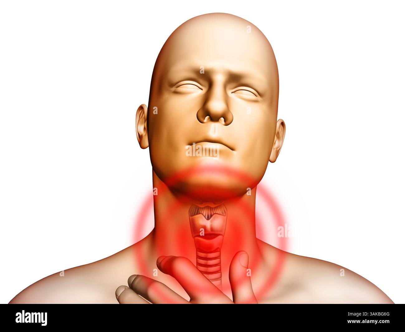 Through Pain Medical illustration showingt pain located in the throat area. Digital ...