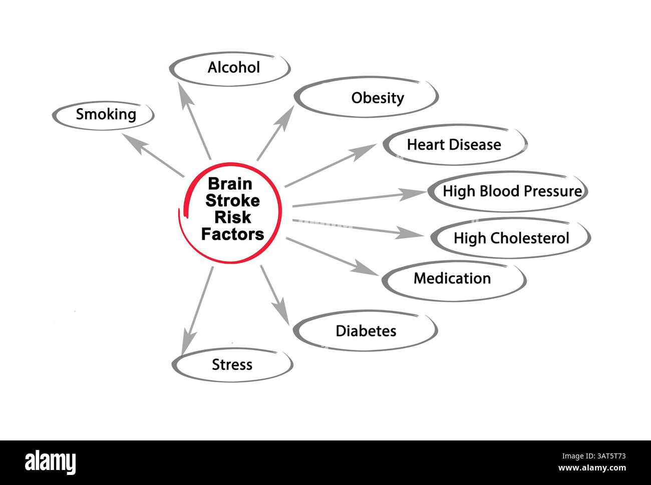 Nine Risk Factors for Brain Stroke Stock Photo - Alamy