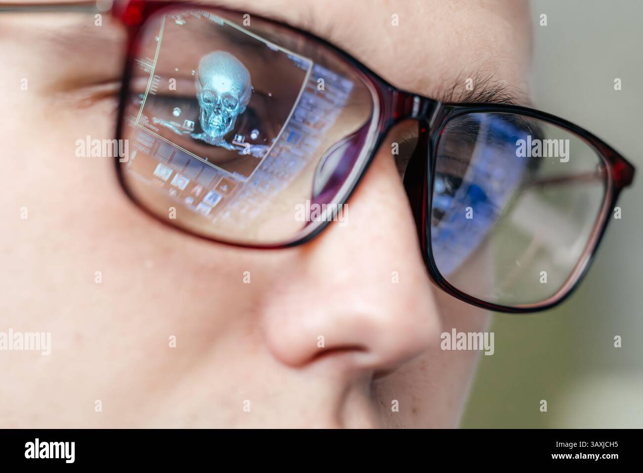 A specialist views MRI scans of the patient's brain, which are reflected in the glasses. The concept of modern technology and accurate diagnosis. Stock Photo