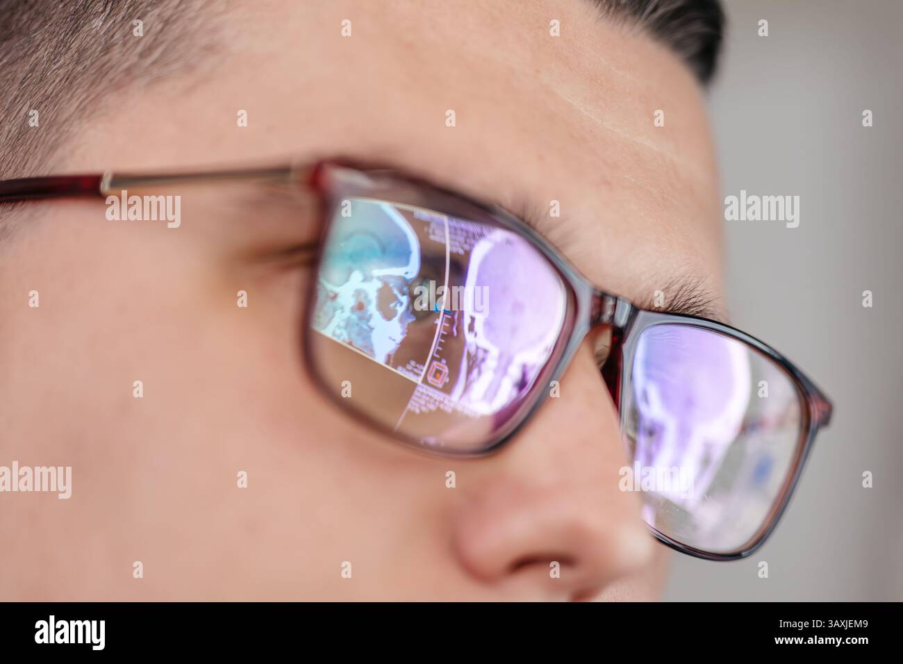 A specialist views MRI scans of the patient's brain, which are reflected in the glasses. The concept of modern technology and accurate diagnosis. Stock Photo