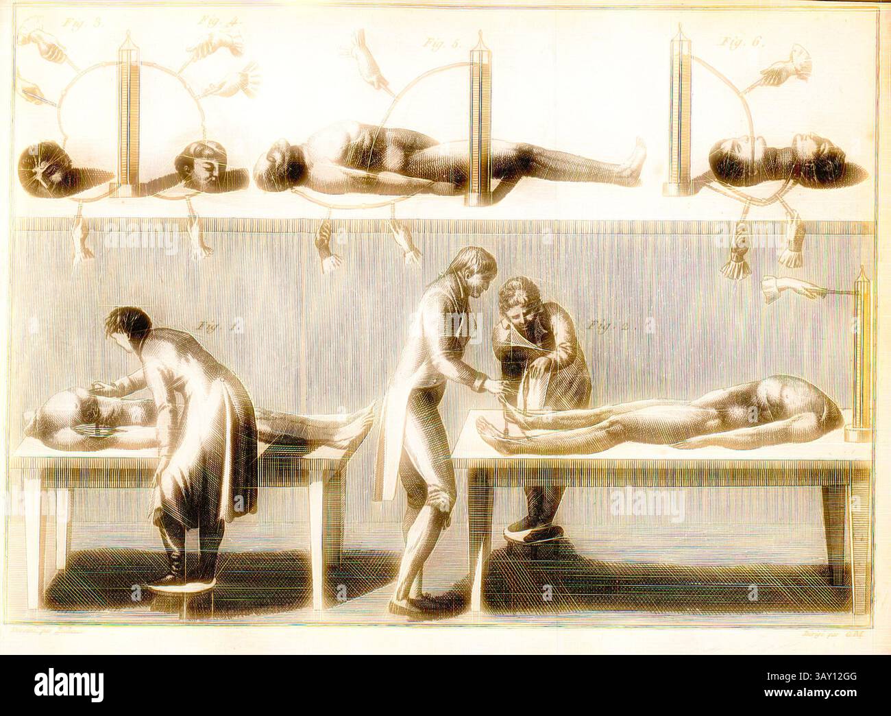 Featuring detailed representations of dissection hi-res stock ...